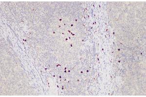Immunohistochemistry of paraffin-embedded Human tonsil using S100A12 Polycloanl Antibody at dilution of 1:85 (S100A12 抗体)