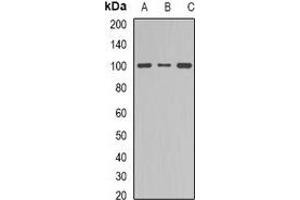 Western blot analysis of Dynamin 1 expression in NIH3T3 (A), mouse brain (B), PC12 (C) whole cell lysates. (Dynamin 1 抗体  (C-Term))