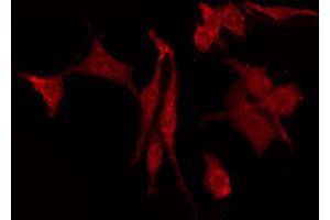 ABIN6274407 staining HepG2 by IF/ICC. (DOK3 抗体  (Internal Region))