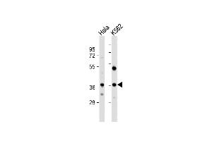 All lanes : Anti-CTDSPL Antibody (N-term) at 1:1000 dilution Lane 1: Hela whole cell lysate Lane 2: K562 whole cell lysate Lysates/proteins at 20 μg per lane. (CTDSPL 抗体  (N-Term))