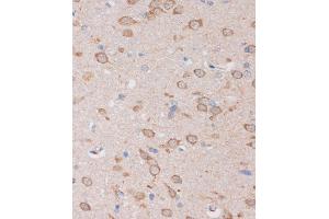 Immunohistochemistry of paraffin-embedded Rat brain using STIM2 Rabbit pAb (ABIN7270611) at dilution of 1:100 (40x lens). (Stim2 抗体  (AA 60-180))