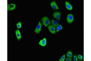 Immunofluorescent analysis of A549 cells using ABIN7150558 at dilution of 1:100 and Alexa Fluor 488-congugated AffiniPure Goat Anti-Rabbit IgG(H+L) (DNAJC4 抗体  (AA 1-155))