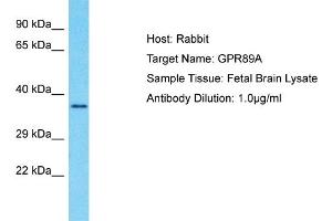 Host: Rabbit Target Name: GPR89A Sample Type: Fetal Brain lysates Antibody Dilution: 1. (GPR89A 抗体  (C-Term))