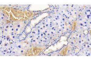 Detection of HB in Rat Adrenal gland Tissue using Polyclonal Antibody to Hemoglobin (HB) (Hemoglobin 抗体)