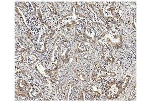 IHC analysis of Methylmalonyl Coenzyme A using anti-Methylmalonyl Coenzyme A antibody (ABIN7603112). (MUT 抗体  (N-Term))