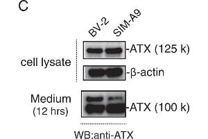 Western Blotting (WB) image for anti-Ectonucleotide Pyrophosphatase/phosphodiesterase 2 (ENPP2) (C-Term) antibody (ABIN2856278)