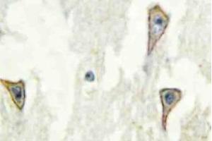 Immunohistochemistry (IHC) analyzes of A Cyclase I antibosy in paraffin-embedded human brain tissue. (ADCY1 抗体)