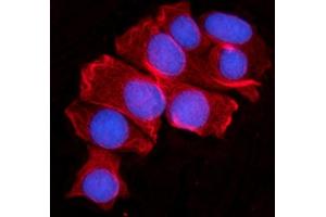 IF analysis of MOV10 using anti-MOV10 antibody (ABIN7600236). (MOV10 抗体  (AA 167-772))