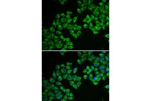 Immunofluorescence analysis of A549 cell using HMGCR antibody. (HMGCR 抗体)