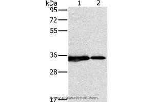 Western blot analysis of 231 and Jurkat cell, using NDUFAF1 Polyclonal Antibody at dilution of 1:500 (NDUFAF1 抗体)