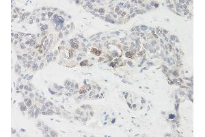 Immunohistochemistry (IHC) image for anti-Nephroblastoma Overexpressed (NOV) antibody (ABIN2474328) (NOV 抗体)