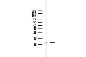 Western blot analysis of lysates from HUVEC cells(starvation,24h treatment), using Acetyl-Histone H3 (Lys18) Antibody at 1/1000 dilution.