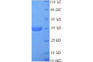 SDS-PAGE (SDS) image for CD46 (CD46) (AA 45-329), (Extracellular) protein (His tag) (ABIN5709237)