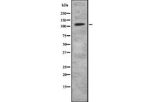 Western blot analysis of MKL2 using HuvEc whole cell lysates (MKL2 抗体  (Internal Region))