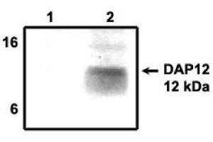 Image no. 1 for anti-TYRO Protein tyrosine Kinase Binding Protein (TYROBP) antibody (ABIN265057) (TYROBP 抗体)