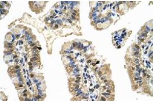 Immunohistochemical staining (Formalin-fixed paraffin-embedded sections) of human intestine with MCM8 polyclonal antibody  at 4-8 ug/mL working concentration. (MCM8 抗体  (C-Term))