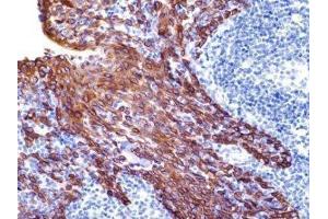 Immunohistochemistry (IHC) image for anti-Keratin 19 (KRT19) (C-Term) antibody (ABIN870577) (Cytokeratin 19 抗体  (C-Term))