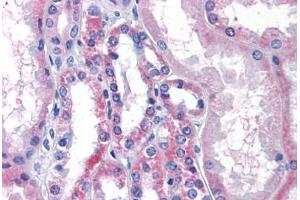 Kidney, Human: Formalin-Fixed, Paraffin-Embedded (FFPE) (LPCAT1 抗体  (Internal Region))