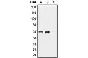 Western blot analysis of CLK2 expression in HL60 (A), HeLa (B), HepG2 (C) whole cell lysates.