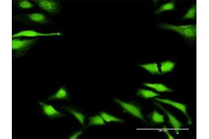 Immunofluorescence of purified MaxPab antibody to DUSP23 on HeLa cell. (DUSP23 抗体  (AA 1-150))