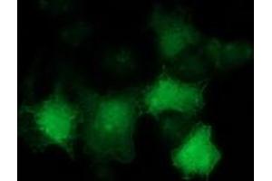 Anti-TP53 mouse monoclonal antibody (ABIN2454669) immunofluorescent staining of COS7 cells transiently transfected by pCMV6-ENTRY TP53 (RC200003). (p53 抗体)