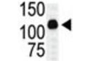 Western Blotting (WB) image for anti-Mitogen-Activated Protein Kinase Kinase Kinase 10 (MAP3K10) antibody (ABIN3003575) (MAP3K10 抗体)
