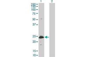 Western Blot analysis of HSPB8 expression in transfected 293T cell line by HSPB8 monoclonal antibody (M03), clone 5C3. (HSPB8 抗体  (AA 97-196))