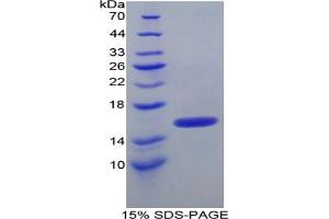 SDS-PAGE of Protein Standard from the Kit  (Highly purified E. (ITIH4 ELISA 试剂盒)