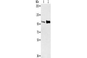 Western Blotting (WB) image for anti-Actinin, alpha 2 (ACTN2) antibody (ABIN2427123)