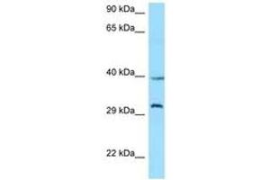 Image no. 1 for anti-Growth Hormone Secretagogue Receptor (GHSR) (C-Term) antibody (ABIN6748194)