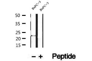 Western blot analysis of extracts of BxPC-3 cells, using REEP6 antibody.