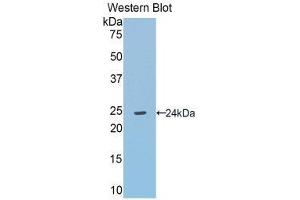 Western Blotting (WB) image for anti-Angiotensinogen (serpin Peptidase Inhibitor, Clade A, Member 8) (AGT) (AA 155-355) antibody (ABIN1857946) (AGT 抗体  (AA 155-355))