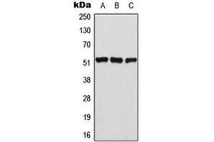 Western blot analysis of ATF2 (pT69) expression in HeLa (A), NIH3T3 (B), PC12 (C) whole cell lysates. (ATF2 抗体  (N-Term, pSer69))