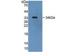 Detection of Recombinant MAP2K6, Human using Polyclonal Antibody to Mitogen Activated Protein Kinase Kinase 6 (MAP2K6)