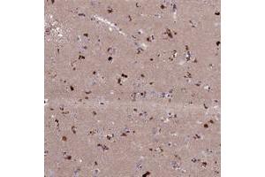 Immunohistochemical staining of human lateral ventricle with ADO polyclonal antibody  shows strong cytoplasmic positivity in neuronal cells. (ADO 抗体)