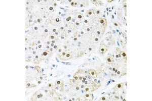 Immunohistochemistry of paraffin-embedded human stomach using BCCIP antibody at dilution of 1:100 (x40 lens). (BCCIP 抗体)