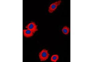Immunofluorescent analysis of NBL1 staining in Raw264. (NBL1 抗体  (C-Term))