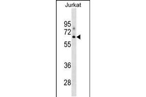 Western blot analysis in Jurkat cell line lysates (35ug/lane). (XYLB 抗体  (N-Term))