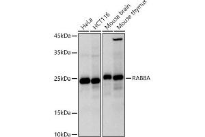 Western blot analysis of extracts of various cell lines, using RA antibody (ABIN7269814) at 1:1000 dilution. (RAB8A 抗体)