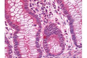 Immunohistochemistry (IHC) image for anti-V-Set Domain Containing T Cell Activation Inhibitor 1 (VTCN1) (AA 26-258) antibody (FITC) (ABIN1957215)