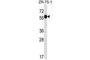 C6orf211 Antibody (N-term) western blot analysis in ZR-75-1 cell line lysates (35µg/lane). (C6ORF211 抗体  (N-Term))