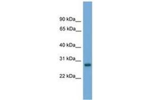 Image no. 1 for anti-Activator of Basal Transcription 1 (Abt1) (AA 171-220) antibody (ABIN6744581) (Activator of Basal Transcription 1 抗体  (AA 171-220))