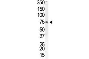Western Blotting (WB) image for anti-Phosphatidylinositol-4-Phosphate 5-Kinase, Type I, beta (PIP5K1B) (AA 1-30) antibody (ABIN3032218)