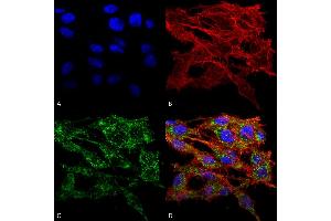 Immunocytochemistry/Immunofluorescence analysis using Rabbit Anti-VMP1 Polyclonal Antibody . (VMP1 抗体  (AA 391-402) (PE))