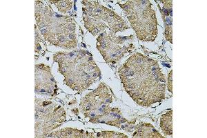 Immunohistochemistry of paraffin-embedded human stomach using CPOX antibody. (CPOX 抗体  (AA 111-454))