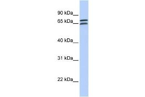 Western Blotting (WB) image for anti-DCP1 Decapping Enzyme Homolog B (DCP1B) antibody (ABIN2459448) (DCP1B 抗体)