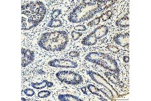 IHC analysis of MTA2 using anti-MTA2 antibody (ABIN7599519). (MTA2 抗体  (AA 1-668))