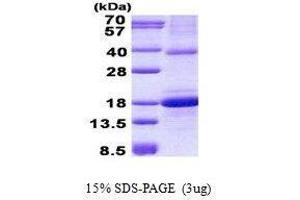 SDS-PAGE (SDS) image for C-Type Lectin Domain Family 2, Member D (CLEC2D) protein (ABIN2128586)