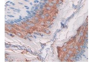 Detection of MST1R in Mouse Stomach Tissue using Polyclonal Antibody to Macrophage Stimulating 1 Receptor (MST1R) (MST1R 抗体  (AA 89-275))