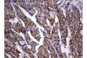 Image no. 3 for anti-3-Oxoacyl-ACP Synthase, Mitochondrial (OXSM) (AA 78-343) antibody (ABIN1491674)